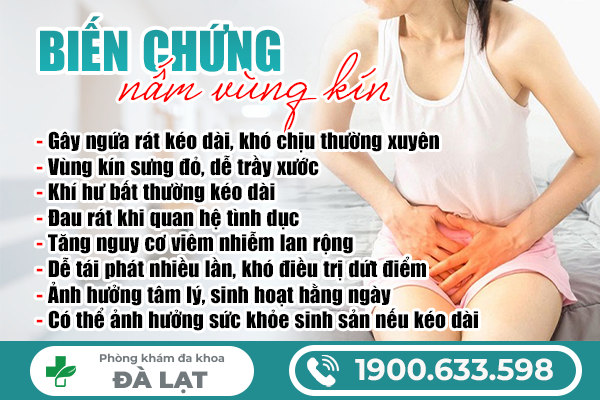 Hình ảnh minh họa
